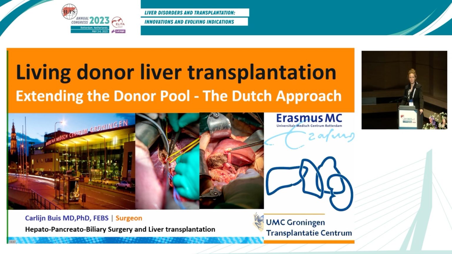 Living donor liver transplantation » ILTS Education